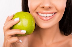Cosmetic Dentistry | Dentist in University City, MO | University Dental Care